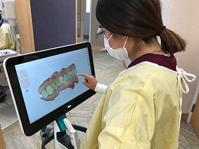 dental assistant looking at computer image of teeth, restorative dentistry Millbrae, CA